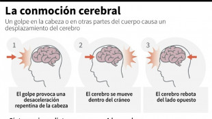 Argentina realiza estudio pionero en América Latina sobre lesiones cerebrales del rugby