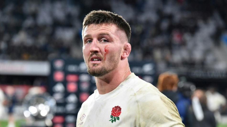 England boss Borthwick adamant Curry fit to face Japan after latest concussion